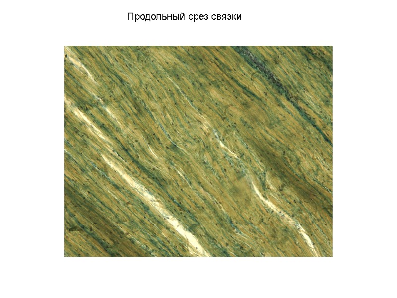 Продольный срез связки